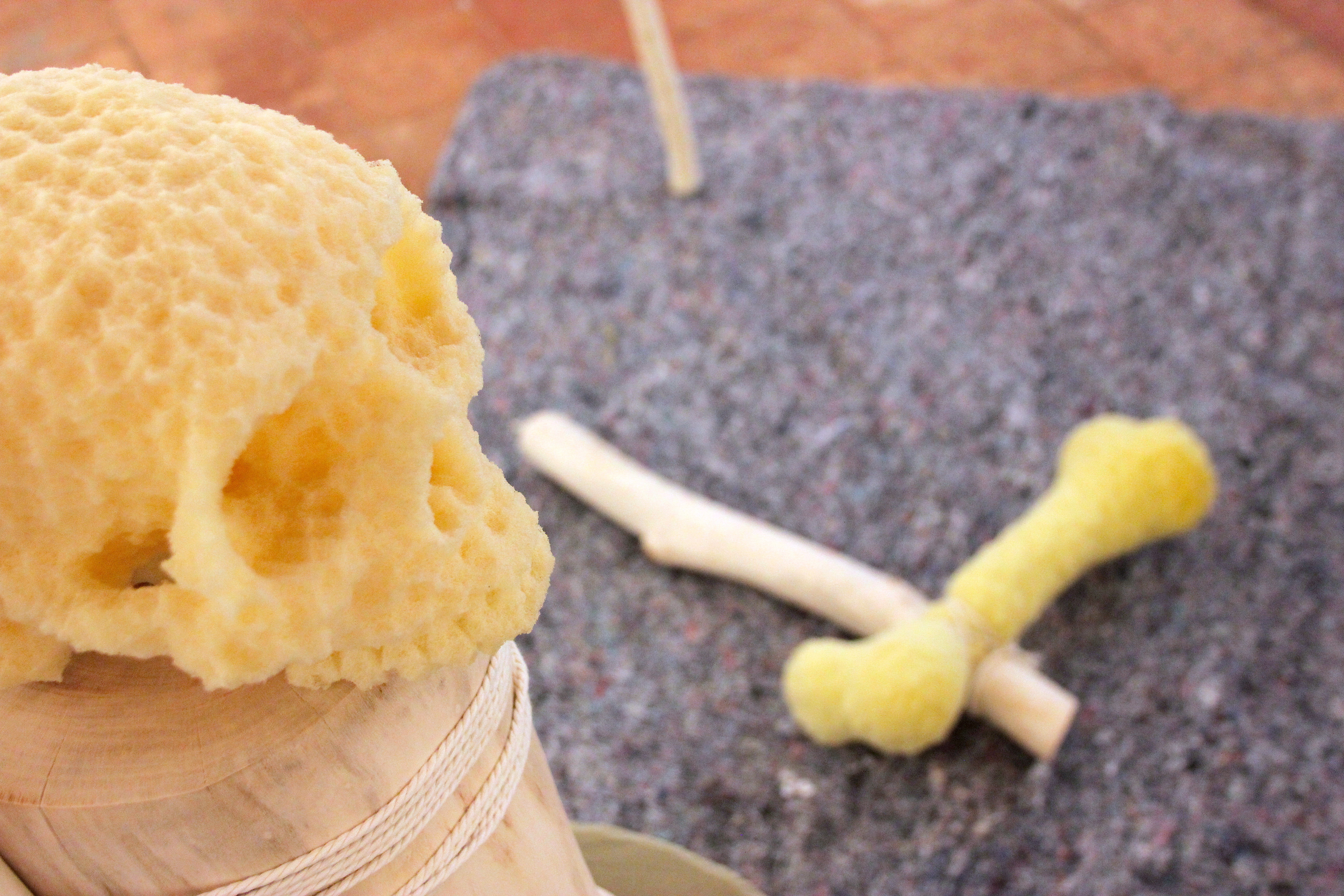 os-resectum-detail-2